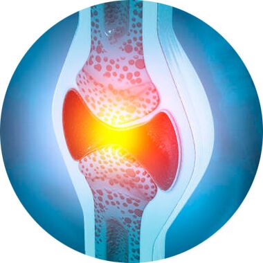 Proceso de recuperación articular con xel Icexin