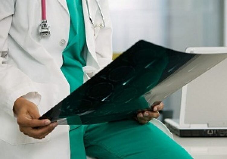 Os raios X axudan ao médico a diagnosticar a osteocondrose da columna torácica