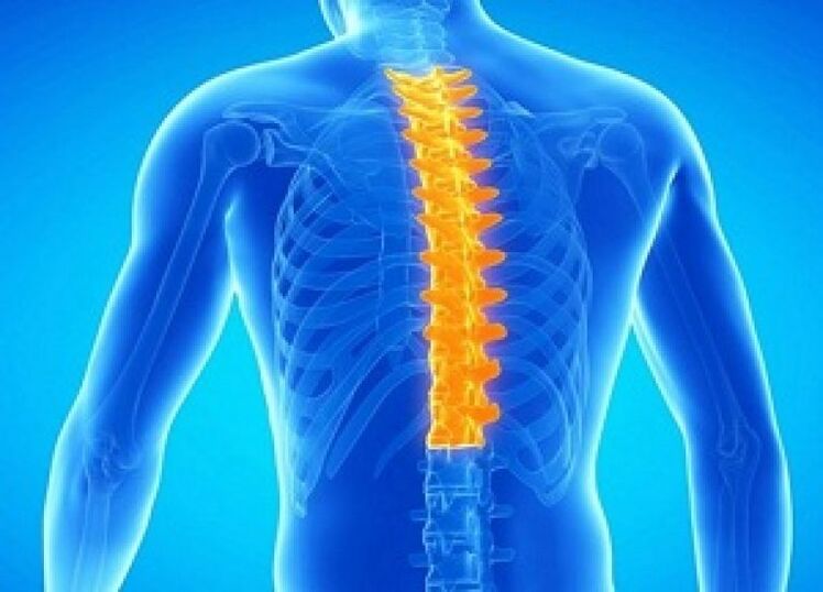 Osteocondrose da columna torácica